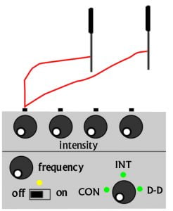 electroacupuncture